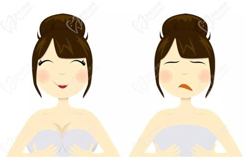 朱云醫(yī)生隆胸口碑